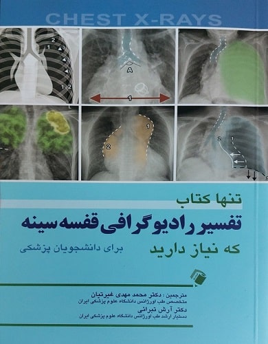 کتاب تنها کتاب تفسیر رادیوگرافی قفسه سینه که نیاز دارید
