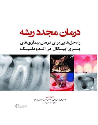 کتاب درمان مجدد ریشه